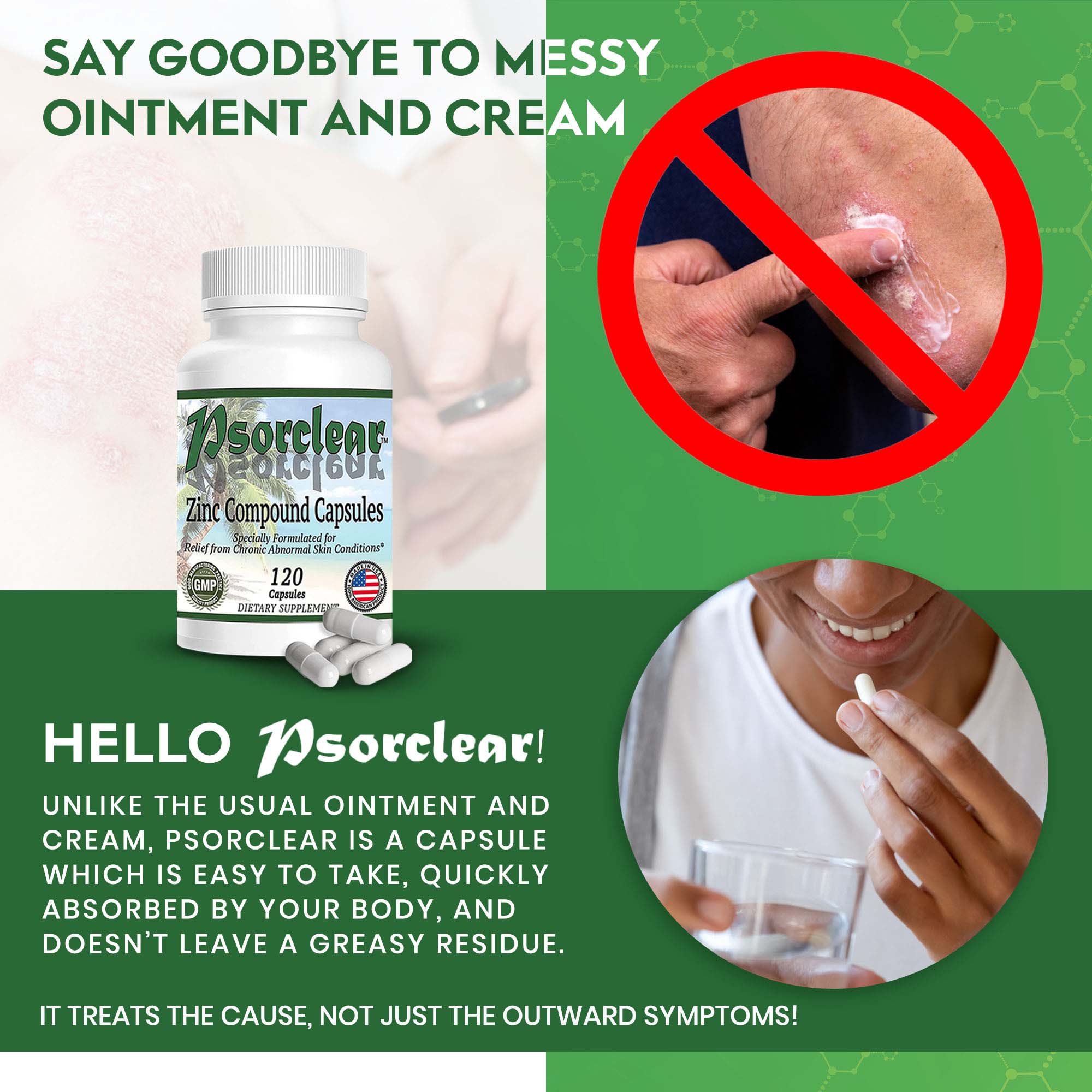 No More Creams or Ointments