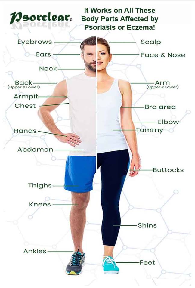 Psorclear body